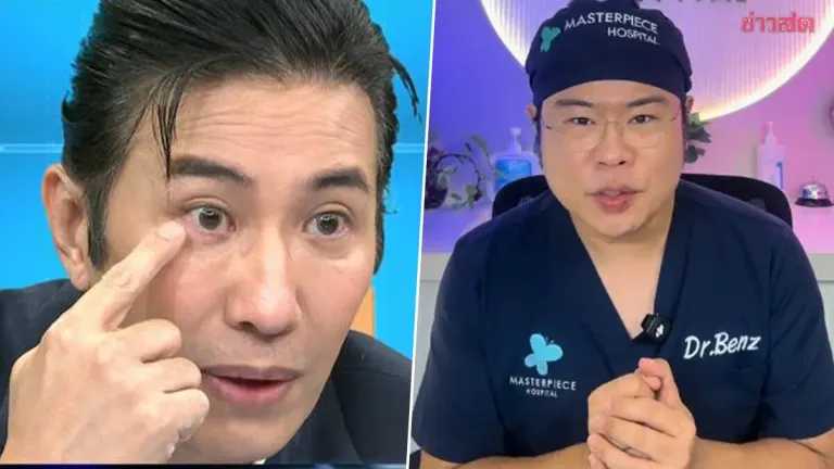 Doctor Warns: Eye Ring Sign May Signal Dangerous Cholesterol Levels