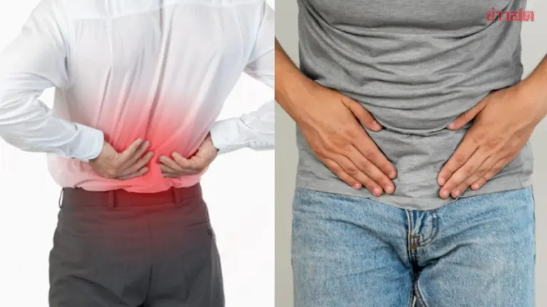 Three-Year Back Pain Masks Stage 4 Prostate Cancer