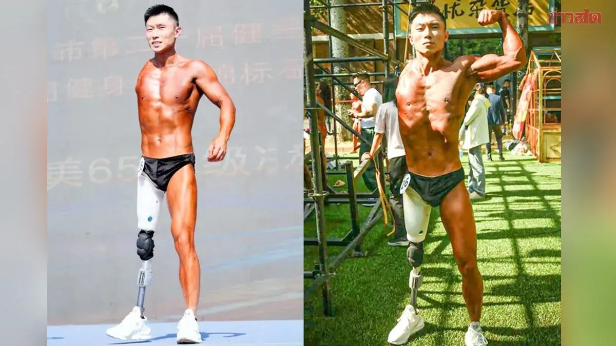 Life-Changing Accident: Chinese Man Loses Arms and Legs, But Rises Up to Become a Bodybuilder