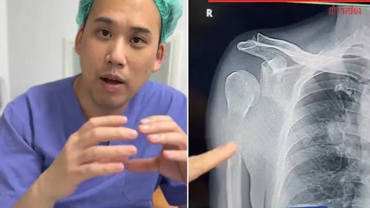 Arm Pain Masks Advanced Lung Cancer Diagnosis