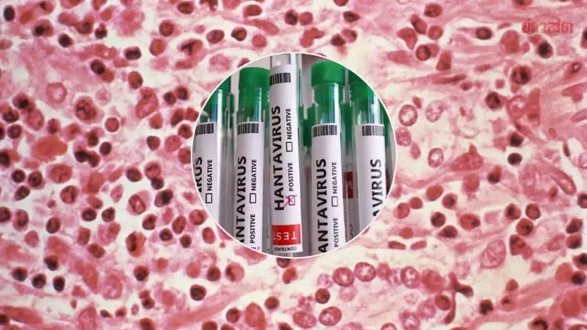 Hantavirus Not Yet Detected in Thailand as Government Intensifies Surveillance and Screening Measures