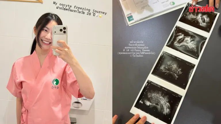 Doctor Frang Shares First Egg Freezing Experience at 28